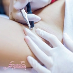 Электроэпиляция - Видеокурс Начальный (фото)